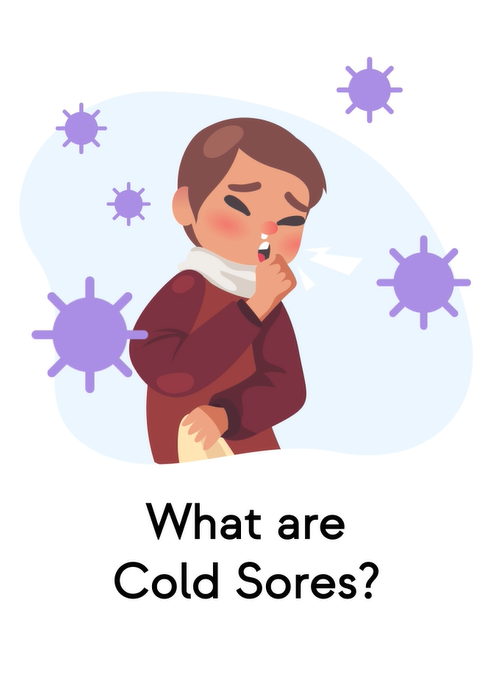 Cold Sores