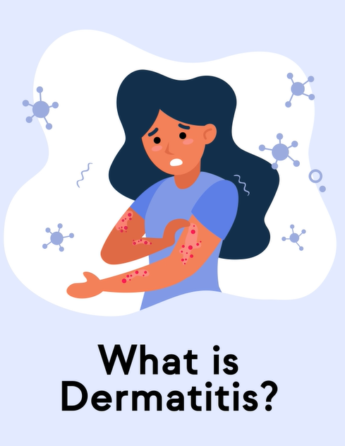 Dermatitis