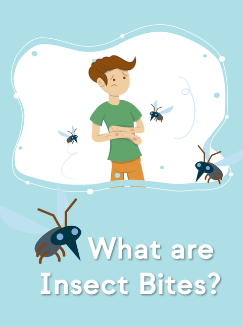 Insect Bites