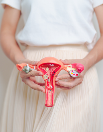 Polycystic Ovarian Syndrome (PCOS)