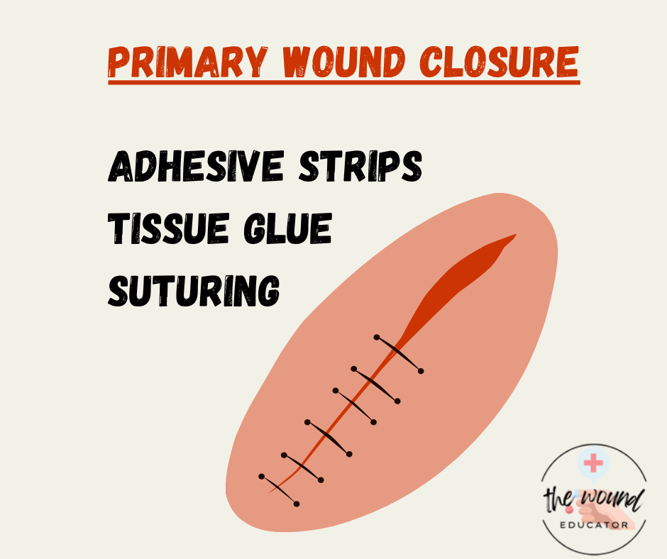 Primary Wound Closure for Pharmacists