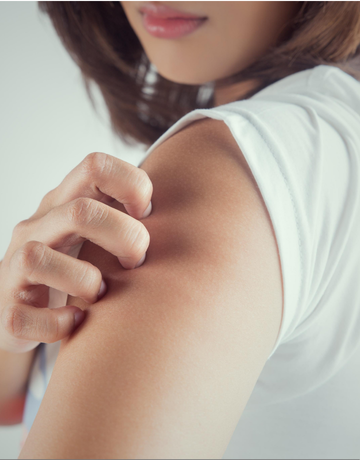 Psoriasis in Community Pharmacy: Recognition, Assessment & Referral Guidance