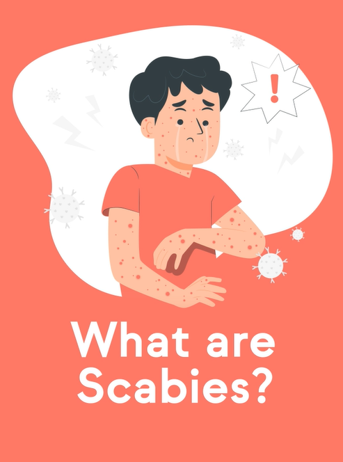 Scabies